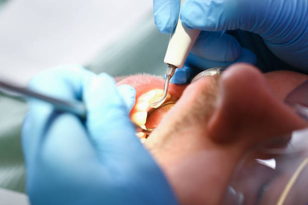 Best Pediatric Emergency Dentist in Seabrook, TX