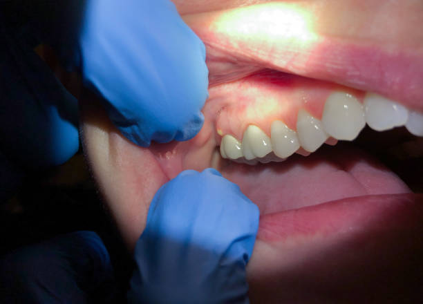 Best Emergency Root Canal Treatment in Seabrook, TX