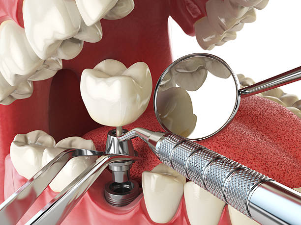 Best Cosmetic Emergency Dentistry in Seabrook, TX